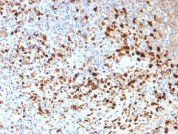 IHC staining of FFPE human cervix with recombinant HSV1 antibody (clone HSV1/1934). Required HIER: b