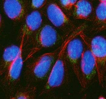Immunofluorescent staining of BCKDH E2/DBT using anti-BCKDH E2 antibody (green) and anti-Beta Tubuli