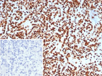 IHC staining of FFPE human lymph node tissue with XRCC5 / Ku86 / Ku80 antibody (clone XRCC5/7313). I