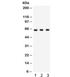 Chk2 Antibody / CHEK2