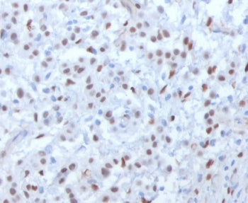 WT1 Antibody / Wilms Tumor 1