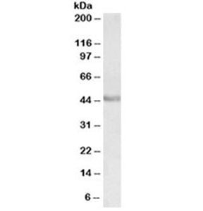 Western blot testing of human duodenum lysate with PAX3 antibody at 0.3ug/ml. Predicted molecular we