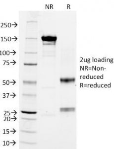 CD18 Antibody / ITGB2 / LFA-1
