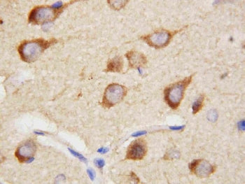 IHC staining of FFPE rat brain tissue with PPID antibody. HIER: boil tissue sections in pH8 EDTA for