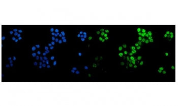 p63 Antibody