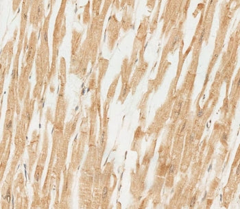 IHC testing of FFPE human heart tissue with RNF4 antibody. HIER: steam section in pH6 citrate buffer
