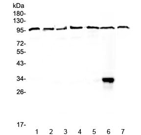 Western blot testing of human 1) HeLa, 2) placenta, 3) COLO320, 4) HepG2, 5) A549, 6) MCF7 and 7) 22