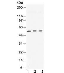 TGFBR1 Antibody / TGF beta receptor I