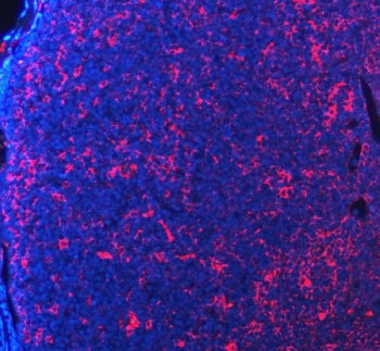PDCD1 Antibody / PD-1 / PD1