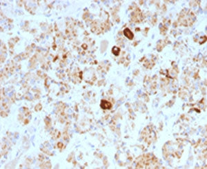 Luteinizing Hormone beta Antibody