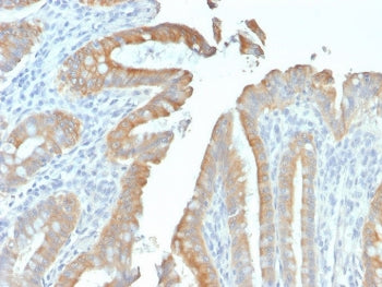 IHC testing of FFPE human colon tissue with recombinant Cytokeratin 19 antibody (clone rKRT19/799). 