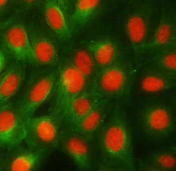 RBMY1A1 Antibody