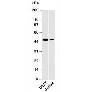 Western blot testing of human samples with DC-SIGN antibody at 2ug/ml. Predicted molecular weight ~4