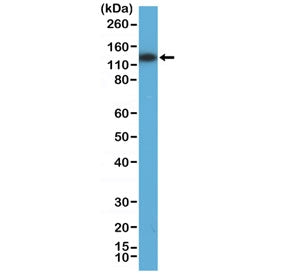 Western blot testing of human HEK293 cell lysate with recombinant MSH3 antibody at 1:800 dilution. P