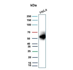 CA9 Antibody / Carbonic Anhydrase IX