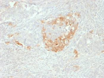 NSE Antibody / Neuron Specific Enolase