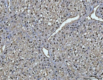 FAA Antibody / FAH / Fumarylacetoacetate hydrolase