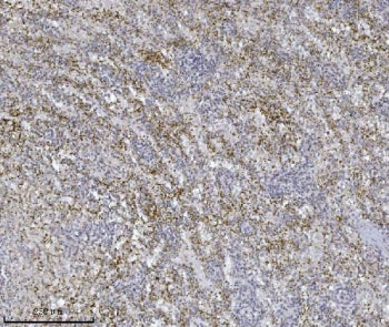 ILK Antibody / Integrin-linked kinase