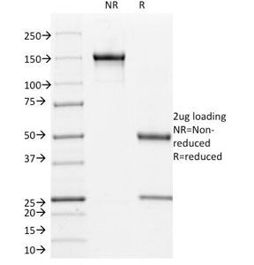 L1CAM Antibody / NCAM-L1 / CD171