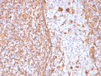 Vimentin Antibody