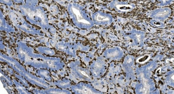 Coronin 1a Antibody / TACO / CORO1A