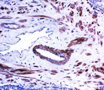 ACE Antibody [Angiotensin Converting Enzyme]