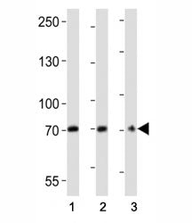 Western blot analysis of lysate from (1) U266, (2) HepG2 cell line, (3) mouse brain tissue lysate us