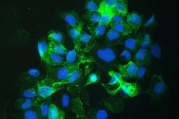 Immunofluorescent staining of FFPE human A431 cells with SLC34A2 antibody (green) and DAPI nuclear s