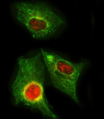 Immunofluorescent staining of FFPE human A549 cells with GNB1 antibody (red) and Beta Tubulin mAb (g