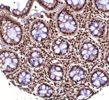 IHC staining of FFPE human colon tissue with Heat shock 70 kDa protein 1B antibody (clone HSPA1B/762