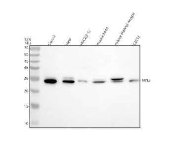 Western blot analysis of MYL3 using anti-MYL3 antibody. Lane 1: human Caco-2 whole cell lysates, Lan