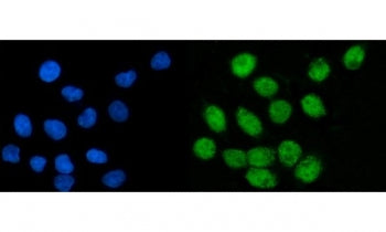 RCOR1 Antibody / REST corepressor 1 / CoREST