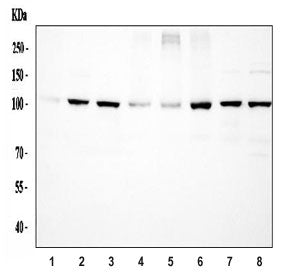 ACTN4 Antibody / Alpha Actinin 4