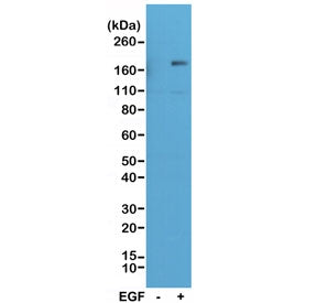 Western blot of A431 cell lysate, untreated (-) or treated (+) with EGF, using recombinant phospho-E
