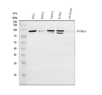 Immunofluorescent staining of FFPE human U-2 OS cells with DYRK1A antibody (red) and DAPI nuclear st