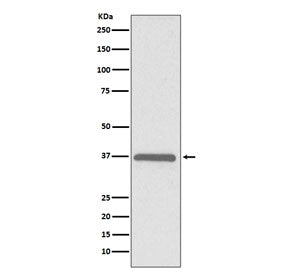 Western blot testing of human HeLa cell lysate with ERCC1 antibody. Predicted molecular weight ~36 k