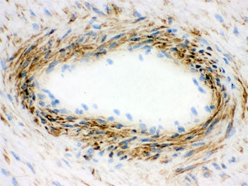 IHC-F testing of frozen human placenta with Actin antibody.