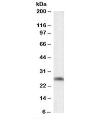 Western blot testing of mouse fetal brain lysate with Ptgds antibody at 0.1ug/ml. Predicted molecula