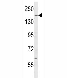 IQGAP2 antibody western blot analysis in mouse testis tissue lysate. Predicted molecular weight ~181