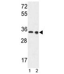 LDHA antibody western blot analysis in 1) Ramos and 2) A375 lysate. Predicted molecular weight ~36kD