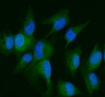 Immunofluorescent staining of FFPE human U-87 MG cells with DDR2 antibody (green) and DAPI nuclear s