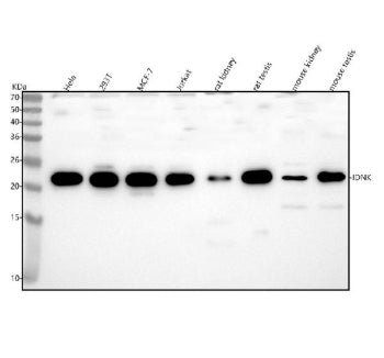 Western blot analysis of IDNK using anti-IDNK antibody. Lane 1: human Hela whole cell lysates, Lane 