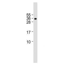 Western blot testing of human U-251 MG cell lysate with BASP1 antibody. Predicted molecular weight ~