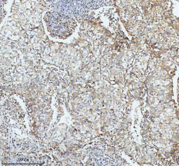 Immunohistochemical staining of SBK1 using anti-SBK1 antibody. SBK1 was detected in a paraffin-embed