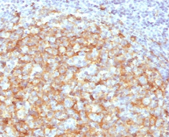 IHC testing of FFPE human lymph node with CD14 antibody (clone CDLA14-2). HIER: boil tissue sections