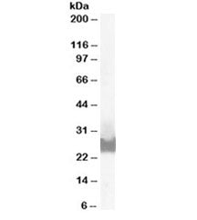 Western blot testing of A431 lysate with BID antibody at 0.1ug/ml. Predicted molecular weight ~26/22