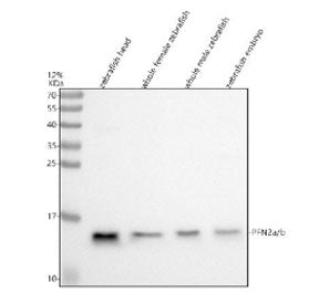 Western blot analysis of Pfn2a/b protein using Zebrafish Pfn2 antibody and 1) zebrafish head, 2) who