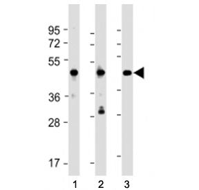 Western blot testing of NSFL1C antibody at 1:2000 + Lane 1: 293, 2: NCI-H1299 and 3: A431 whole cell