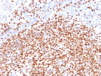 IHC testing of FFPE human lymph node with OCT-2 antibody (clone OCT2/2137). HIER: boil tissue sectio