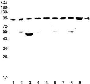 Western blot testing of rat 1) brain, 2) spleen, 3) heart, 4) kidney and mouse 5) brain, 6) spleen, 